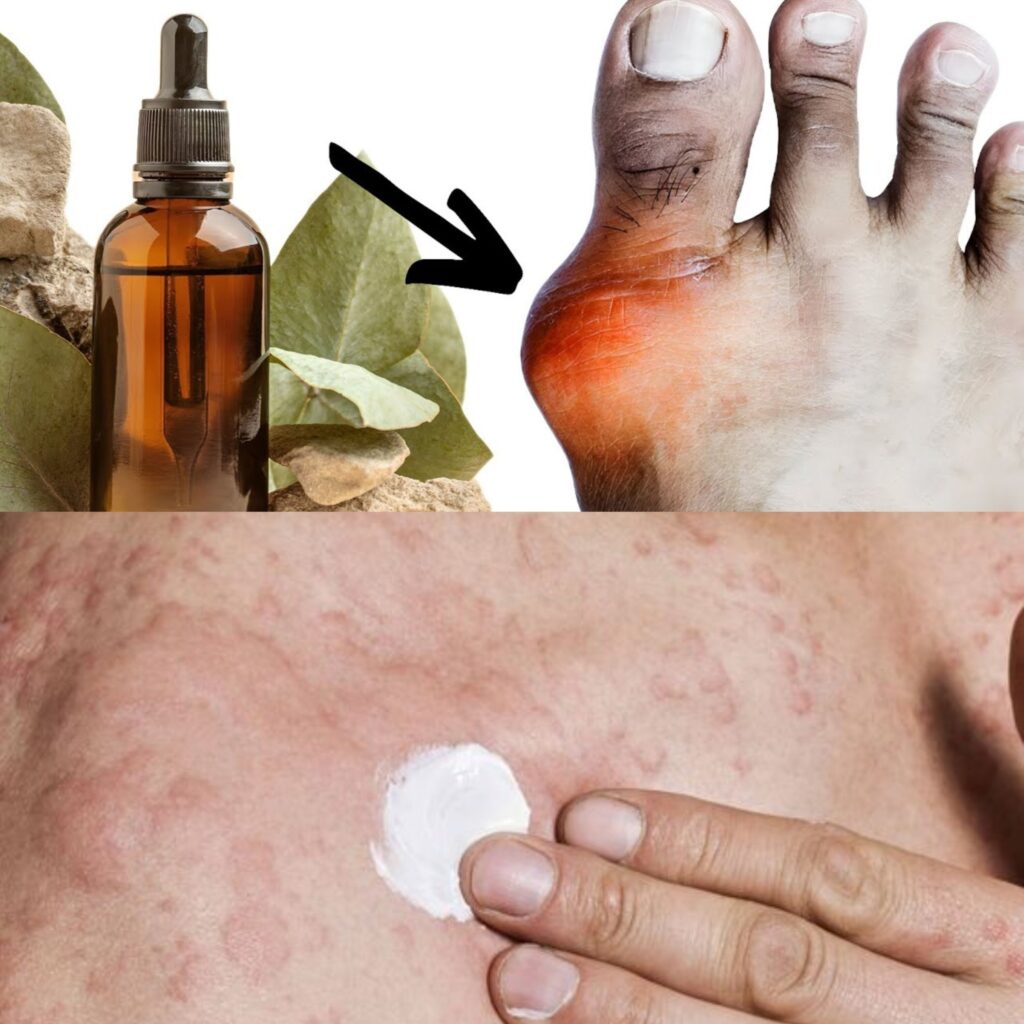 Amazing Oil Cures Gout! Removes Pain, Swelling, Redness…