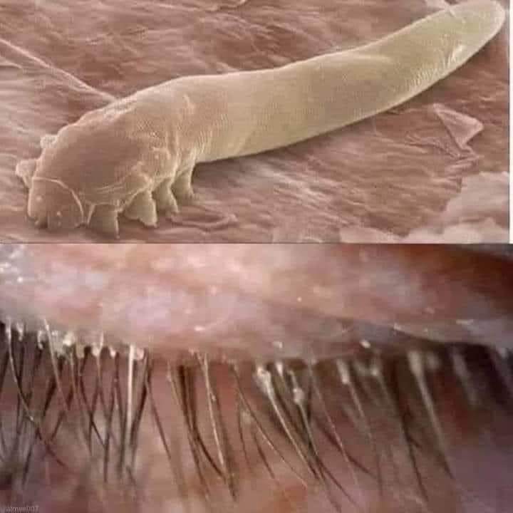 The Hidden World on Your Face: Demodex Mites on Your Eyelashes