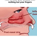 How to clear your sinuses in seconds with nothing but your fingers