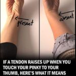 If a Tendon Raises Up When You Touch Your Pinky to Your Thumb, Here’s What It Could Mean