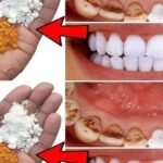 Improve Your Smile: A Fast Way to Make Your Teeth Whiter at Home