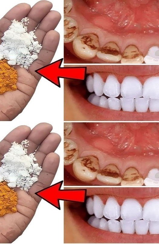 Improve Your Smile: A Fast Way to Make Your Teeth Whiter at Home