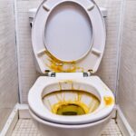 Got yellow stains on underside of toilet seat? Here’s how to get rid of them